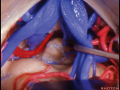 Thumbnail for version as of 16:12, 3 March 2024